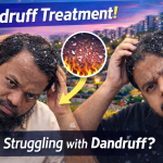 খুশকি প্রতিরোধ