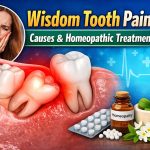 আক্কেল দাঁত